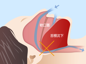 なぜ呼吸が止まるのか？